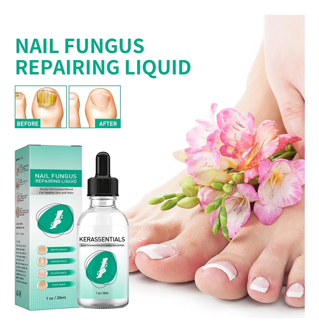 Kerassentials Product
